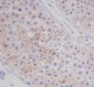 Anti-MAP1LC3A/Lc3A Rabbit Monoclonal Antibody